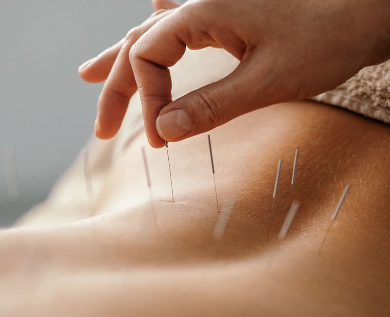 Holistic Therapy by Turbo - Chiropractors in hull